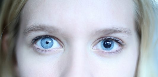 Cuando tus pupilas son asimétricas, la anisocoria