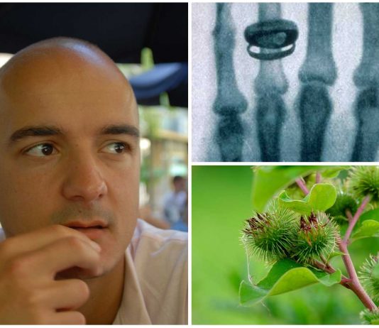 5 increíbles descubrimientos fruto de la casualidad 5 increíbles descubrimientos fruto de la casualidad