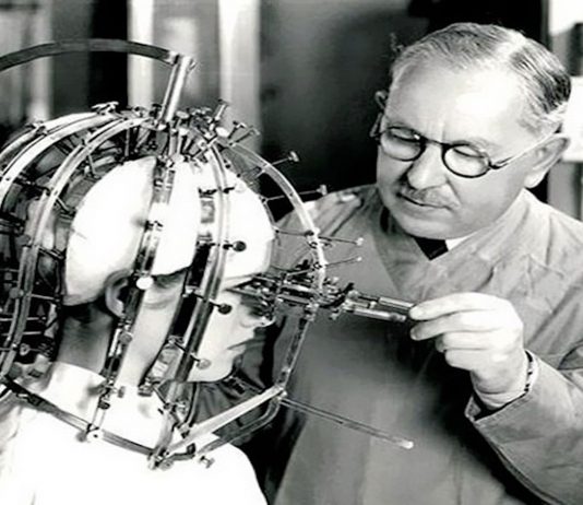 ¿Para qué se usaba este perturbador objeto? ¡Descubre el micrómetro de belleza!