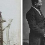 Mujeres con barba, Krao Farini