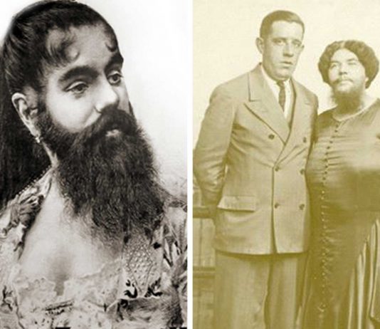 ¿Por qué hay mujeres con barba?