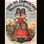 Millie y Christine McKoy, siamesas, esclavas, compradas y vendidas como objetos