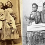 Millie y Christine McKoy, siamesas, esclavas, compradas y vendidas como objetos