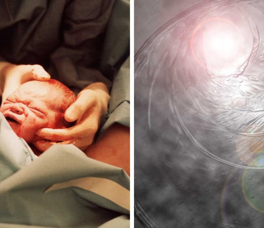 ¿Es posible nacer dos veces? La salud de este bebé no le dejó otra opción