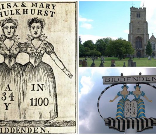 El curioso caso de las siamesas Mary y Eliza Chulkhurst El curioso caso de las siamesas Mary y Eliza Chulkhurst