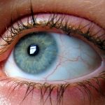 ¿Tienes los ojos azules? En realidad, son marrones