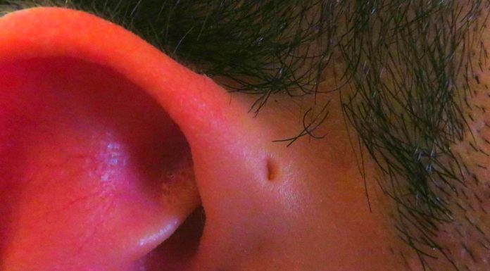 Algunos tienen un agujero de más en la oreja. ¿Qué es?