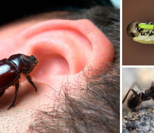 ¿Podría vivir un bicho en un oído? 5 casos espeluznantes