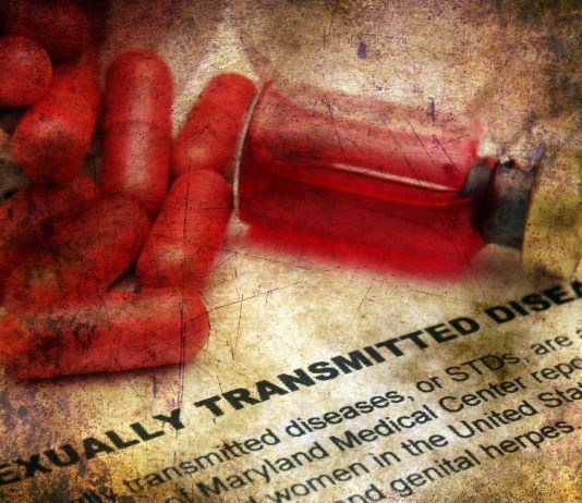 ¿Cómo se contagia el SIDA? Datos que conocer - Supercurioso