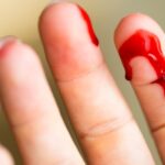 Qué es la Hemofobia