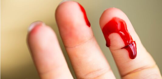 Qué es la Hemofobia | ¿Es normal desmayarse por miedo a la sangre? Qué es la Hemofobia
