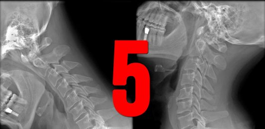 5 descubrimientos fortuitos sin los que hoy no podríamos vivir 5 descubrimientos fortuitos