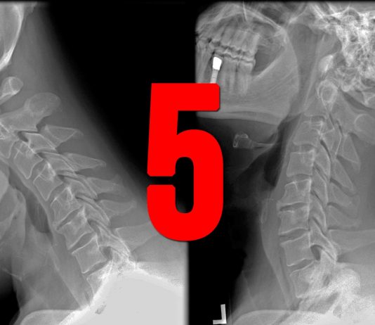 5 descubrimientos fortuitos sin los que hoy no podríamos vivir 5 descubrimientos fortuitos