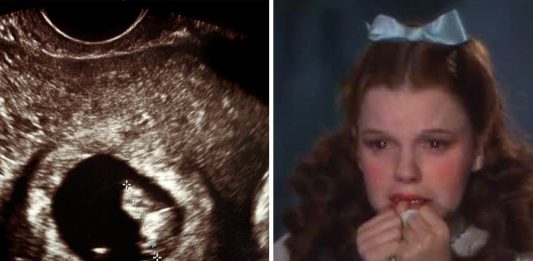 La secreta y obligada práctica de abortos del Hollywood clásico