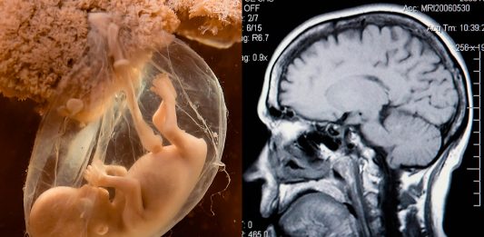 El embarazo cambia el cerebro… ¡hasta mucho después de dar a luz! Descubre cómo El embarazo cambia el cerebro... ¡hasta mucho después de dar a luz! Descubre cómo