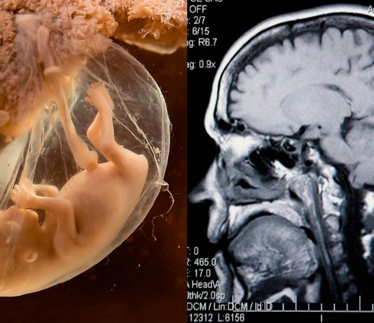 El embarazo cambia el cerebro... ¡hasta mucho después de dar a luz! Descubre cómo