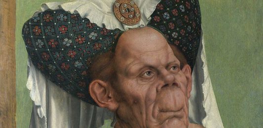 ¿Sabías que el cuadro de la "Duquesa Fea" ocultaba una enfermedad?