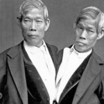 ¿Sabes por qué se llama siameses a los gemelos que nacen pegados? Chang y Eng los increíbles hermanos siameses