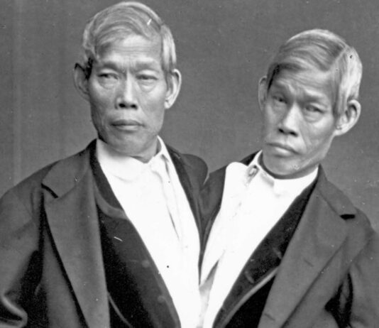 Los siameses Chang y Eng | Le dieron nombre a esta condición siameses chang y eng