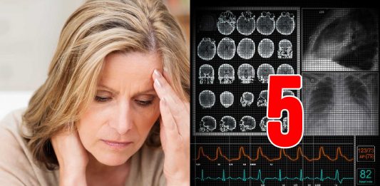 sintomas comunes de la esclerosis múltiple