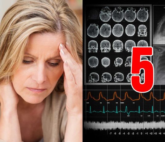 sintomas comunes de la esclerosis múltiple