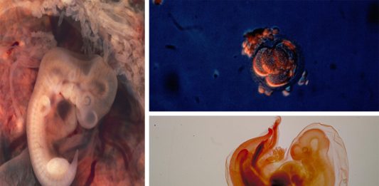 Crean el primer embrión híbrido de humano y cerdo
