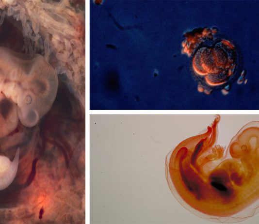 Crean el primer embrión híbrido de humano y cerdo Crean el primer embrión híbrido de humano y cerdo