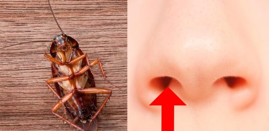 Lo sentimos, pero ha ocurrido: una cucaracha vivía en el cráneo de una mujer y entró por su nariz