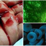 Sangre verde o azul en lugar de roja, ¿es posible?