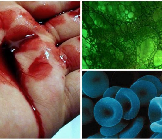 Sangre verde o azul en lugar de roja, ¿es posible?