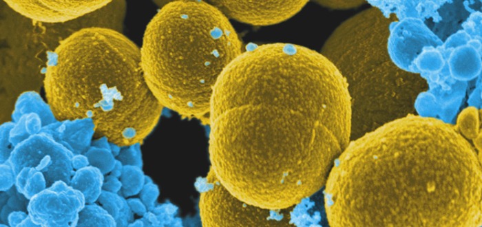 Las 3 Superbacterias que amenazan a la humanidad - Supercurioso