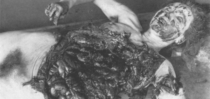 Los PEORES experimentos de la Unidad 731. Aterrador…