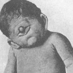 Cíclopes, ¿pudieron existir?
