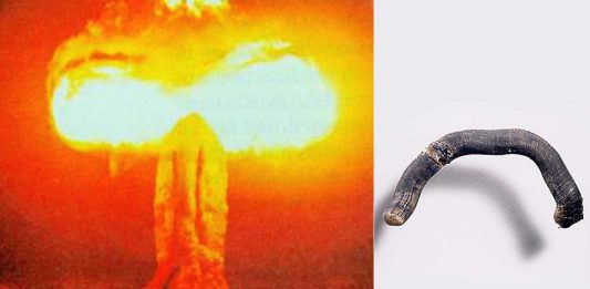 Las uñas negras "vivas" que crecieron a los supervivientes de Hiroshima