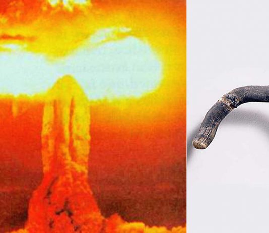 Las uñas negras "vivas" que crecieron a los supervivientes de Hiroshima