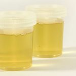 Aclara-la-dentadura-6-datos-inesperados-sobre-la-orina-que-no-querrás-perderte