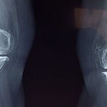 Top 7: Los trabajos más nocivos para nuestra salud