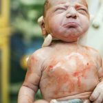 cordón umbilical bebe