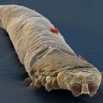 Demodex, los ácaros sin ano que habitan en nuestra cara