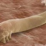 Demodex, los ácaros sin ano que habitan en nuestra cara