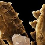 Demodex, los ácaros sin ano que habitan en nuestra cara