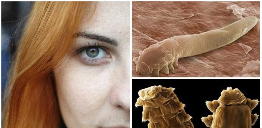 Demodex, los ácaros sin ano que habitan en nuestra cara