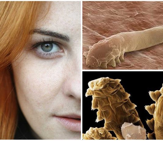 Demodex, los ácaros sin ano que habitan en nuestra cara Demodex, los ácaros sin ano que habitan en nuestra cara