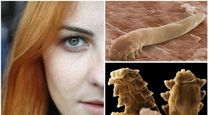 Demodex, los ácaros sin ano que habitan en nuestra cara