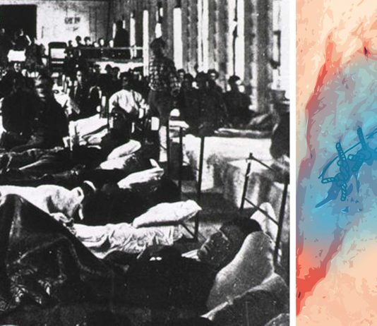 Las heridas que brillaban en la oscuridad en la Guerra Civil Americana. ¡RESUELTO!