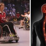 Pacientes paralíticos podrían caminar nuevamente gracias a este invento