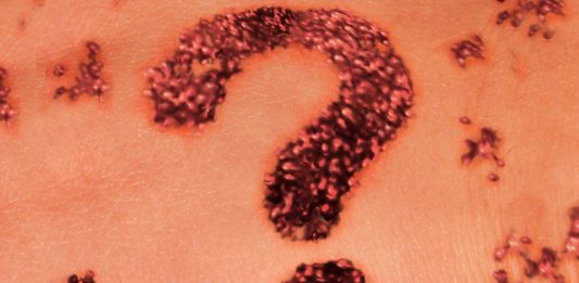 ¿Tienen alguna función los lunares de la piel? ¿Qué debes saber sobre ellos?