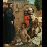 El síndrome de Lázaro o la resurrección espontánea