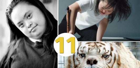 11 Datos curiosos sobre el Síndrome de Down que te interesará saber