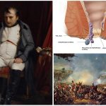 El fin de Napoleón en Waterloo fue por culpa de las hemorroides